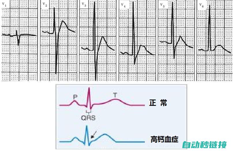 一步步将Step7程序转移到博图平台 (一步步将未曾发生的事情在心灵中预演出来的演讲稿)